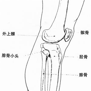 右股骨髁間粉碎性骨折、左髕骨粉碎性骨折被鑒定為七級工傷