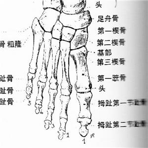 右足第5跖骨基底部骨折被鑒定為十級工傷